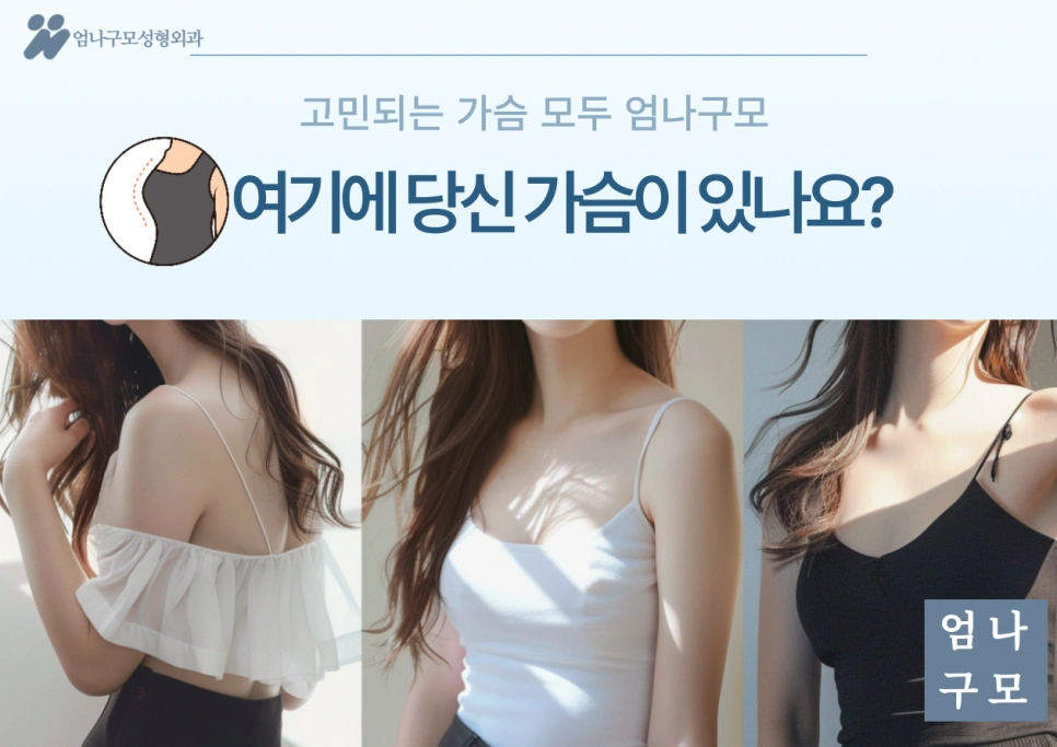 엄나구모성형외과: 가슴 성형의 모든 것 &ndash; 보형물 선택부터 병원 선택까지 안내 이미지