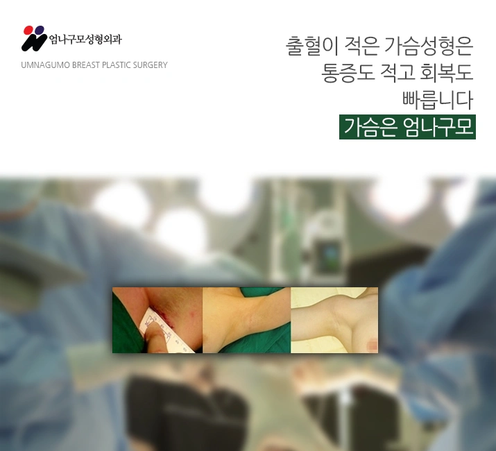 엄나구모 정보글:: 마취걱정 없는 가슴성형 엄나구모 안내 이미지