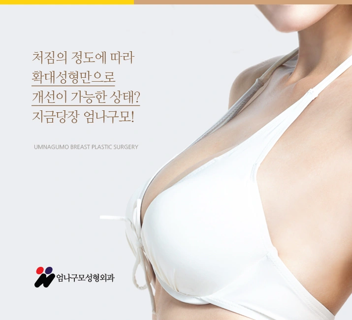 엄나구모정보글>>> 체형에 잘 맞는 모티바 가슴성형~ 안내 이미지