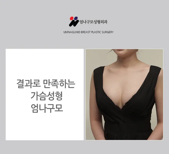 엄나구모 정보글>>> 보형물로 하는 가슴확대술 알아볼까요? 안내 이미지
