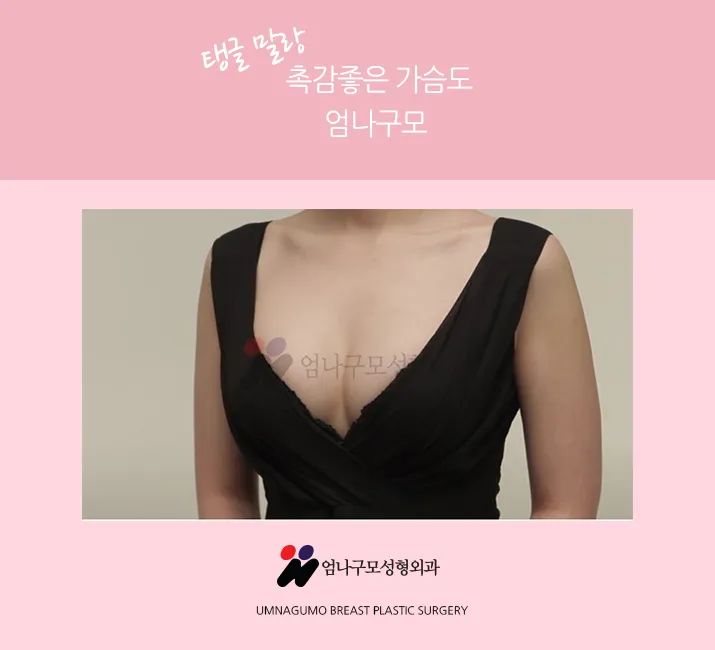 엄나구모정보글 ※ 안전한곳에서 자연스럽고 예쁜 가슴성형~! 안내 이미지