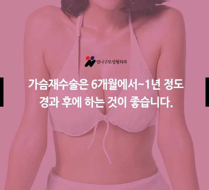 ※엄나구모 정보 글※ 가슴재수술 꼼꼼, 신중!! 안내 이미지