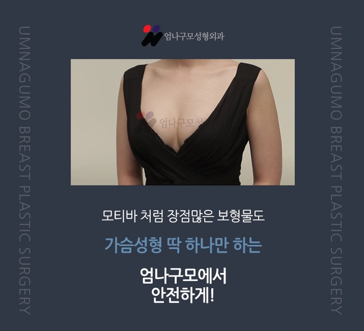 ※엄나구모 정보글※가슴성형! 모티바성형! 궁금해요~ 안내 이미지