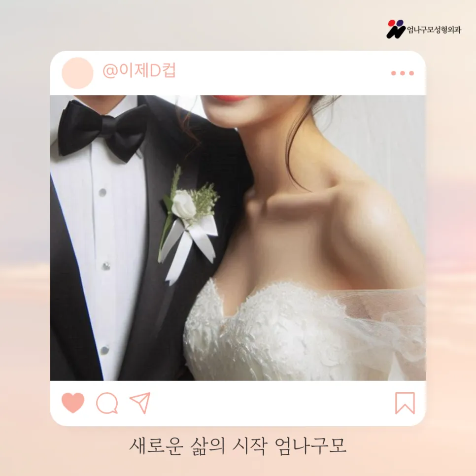 엄나구모성형외과 정보글 가슴 성형, 병원 선택 시 꼭 알아야 할 4가지 팁 안내 이미지