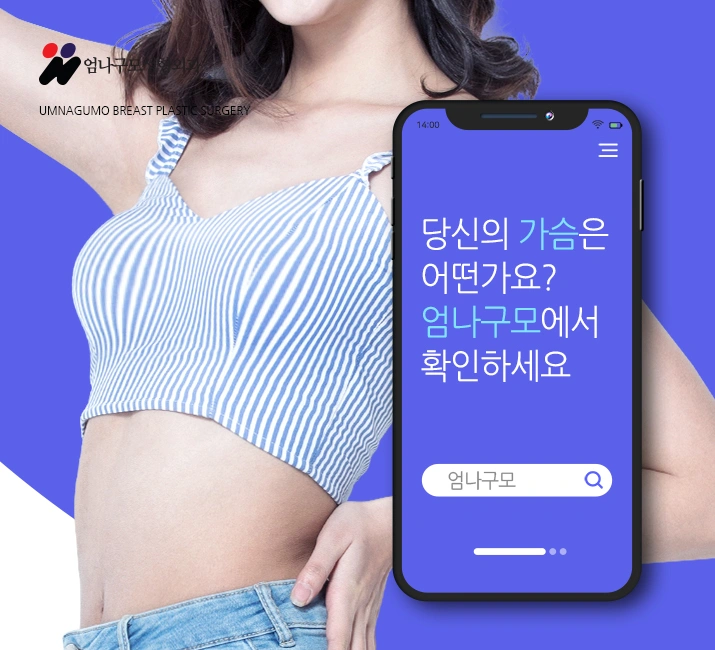 엄나구모 정보글※ 꼼꼼하게 알아보고 가슴성형 진행하기! 안내 이미지