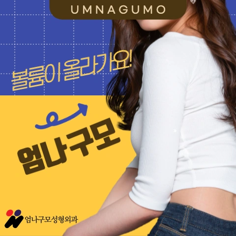 엄나구모 정보 글>> 라인이 살아있네 내 가슴성형 엄나구모!! 안내 이미지