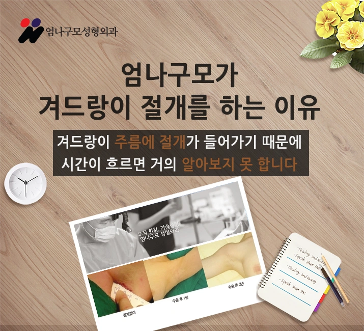 엄나구모만의 가슴수술 원칙!! 안내 이미지
