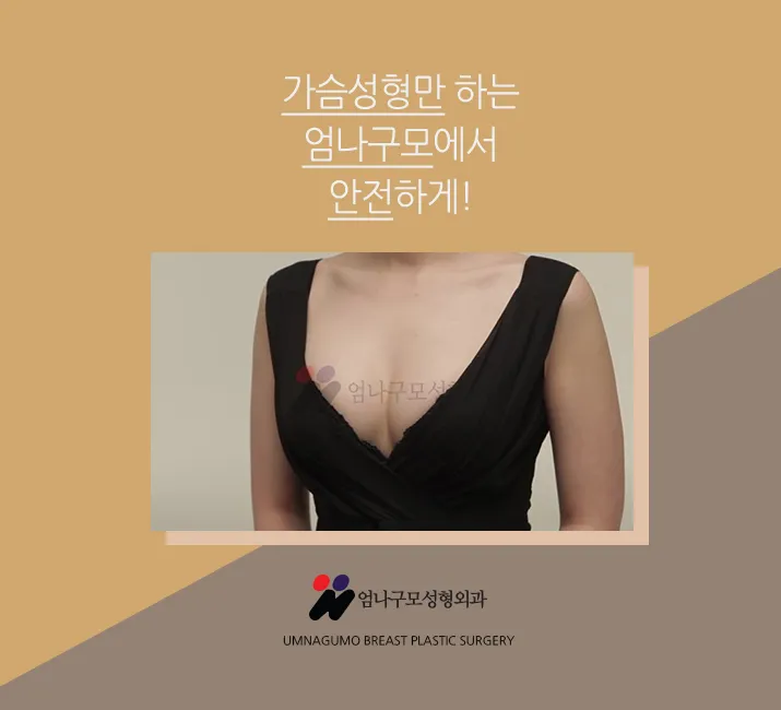 엄나구모정보글>>> 나한테 잘 맞는 가슴성형!! 안내 이미지