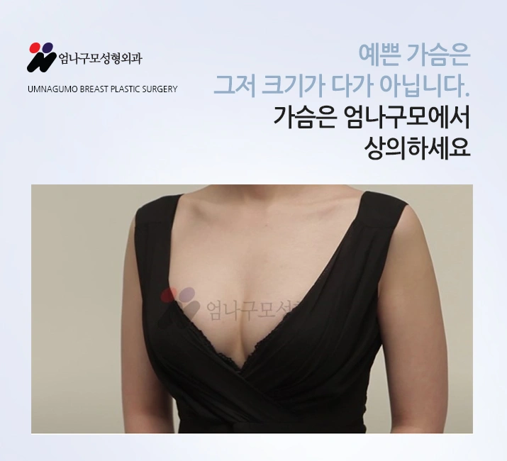모티바 가슴성형 엄나구모 가슴성형 알아볼까? 안내 이미지