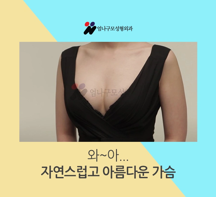 엄나구모 정보 글 ■ 가슴성형 엄나구모를 선택한 이유가 뭐지? 안내 이미지