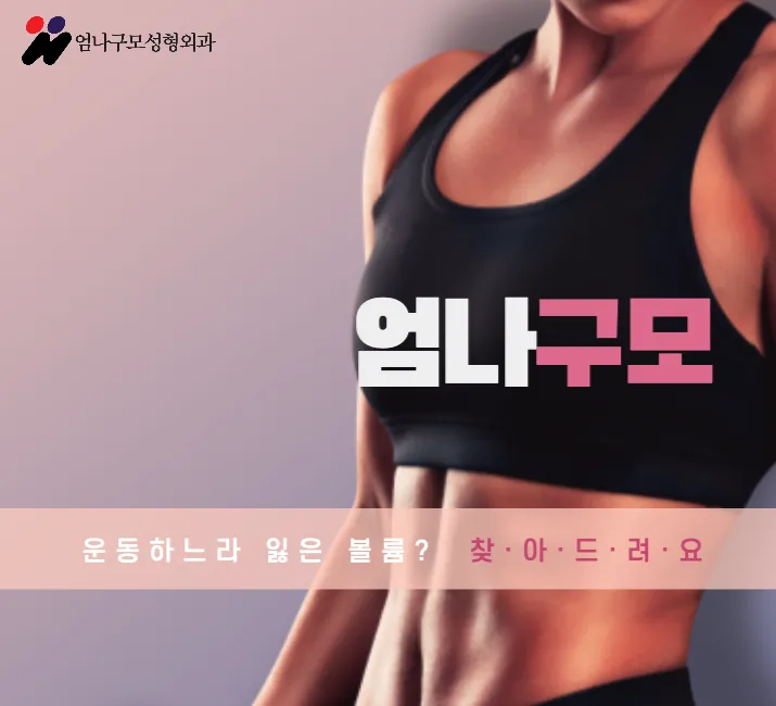 엄나구모 가슴성형 정보글> 예쁘고 안전한 가슴성형?? 엄나구모 하세요~ 안내 이미지