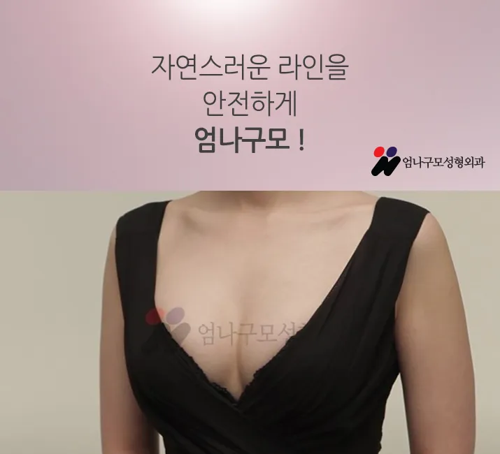 ※가슴성형 고민하시는 분들 주목 엄나구모 모티바가슴성형정보!! 안내 이미지