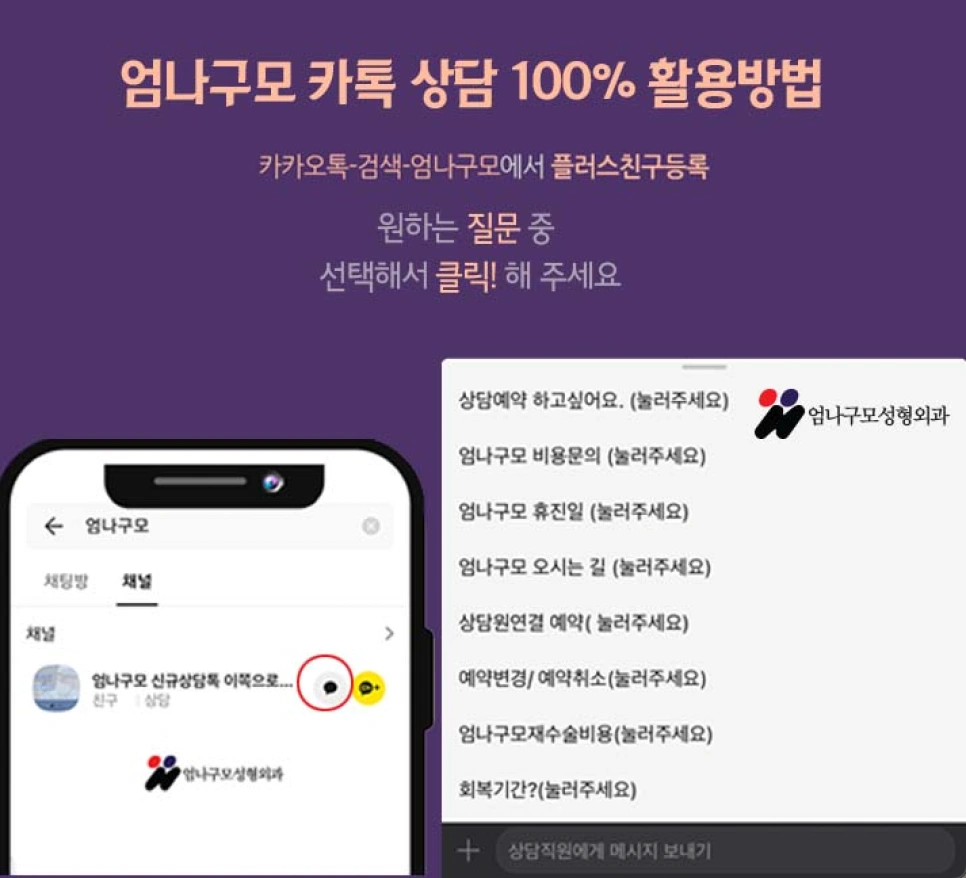 엄나구모 정보글 >>> 보형물 가슴성형 1:1 시스템이어야지!!! 안내 이미지