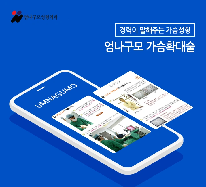 엄나구모정보글 ※ 가슴성형 알아보고 하자~~ 안내 이미지