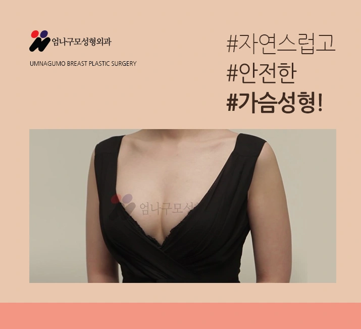 엄나구모정보글※ 유명한 가슴수술잘하는곳?! 선택은 어떻게? 안내 이미지