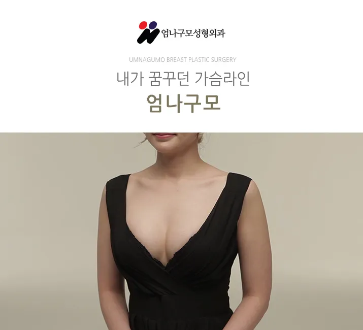엄나구모 정보글::가슴성형은 숙련도에 따라 달라달라 안내 이미지