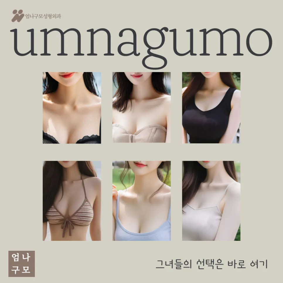 엄나구모성형외과 정보글 멘토엑스트라 스무스 편 안내 이미지
