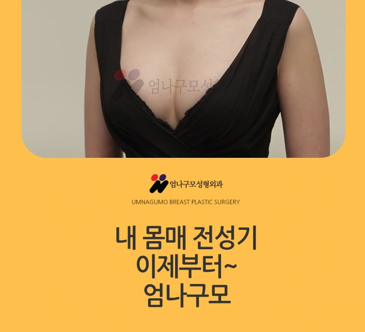 엄나구모 정보 글>> 디자인부터 꼼꼼하게 엄나구모 가슴성형 안내 이미지