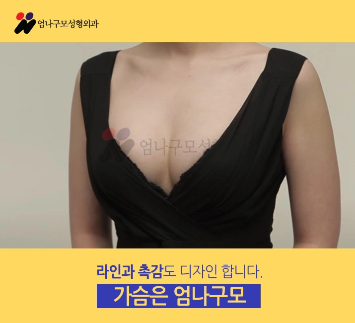 엄나구모 정보글 ※ 가슴성형보형물 삽입수술 이렇게~ 안내 이미지