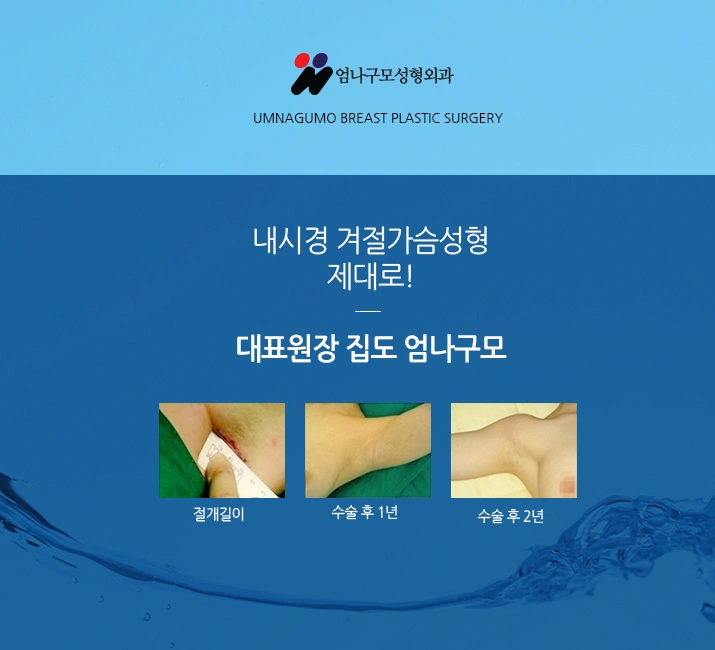 엄나구모 정보글 ※ 가슴재수술 당연히 더 선택이 어렵죠.~! 안내 이미지