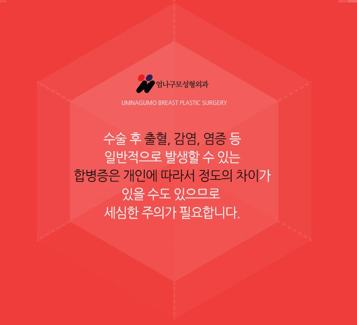 ※엄나구모 정보글※ 처진 가슴 혼자고민하지말고!! 안내 이미지