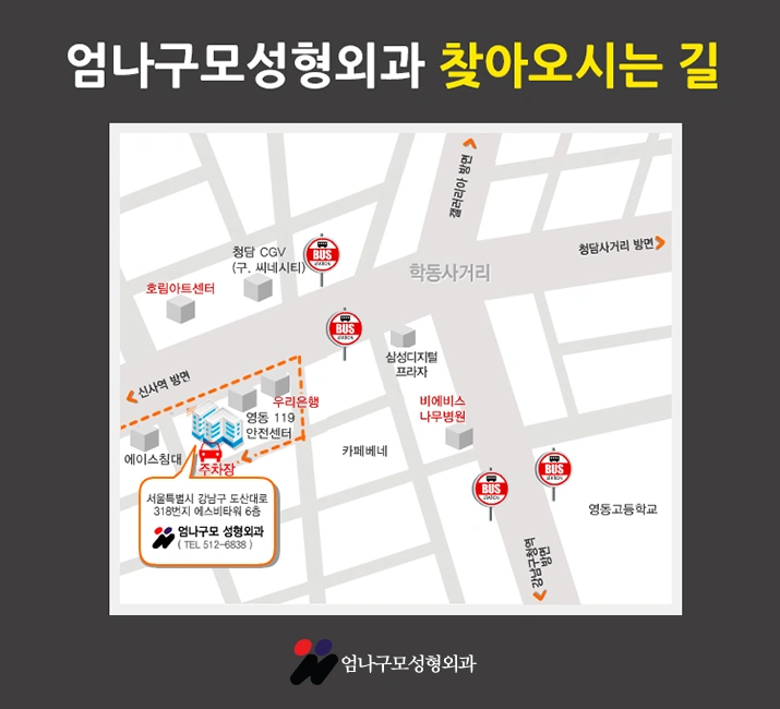 엄나구모 정보글:: 가슴 수술 전 한 번 더 check!! 안내 이미지