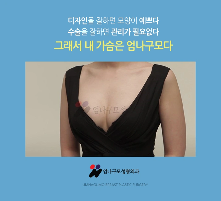 엄나구모 가슴성형>>> 구형구축 최소화 가슴성형!! 안내 이미지
